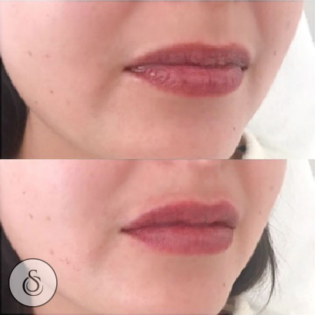 Lèvres hydratées de la Clinique Sarasin