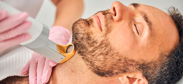 Sarasin Clinic blog laserontharing mannen hals