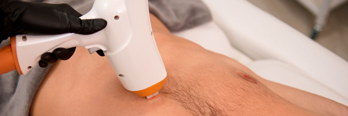 Sarasin Clinic blog laserontharing mannen borst