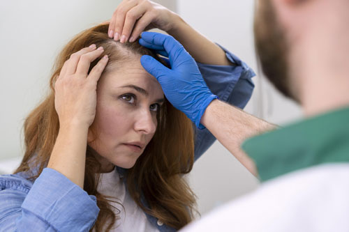 Sarasin Clinic haartransplantatie vrouw haarfiller