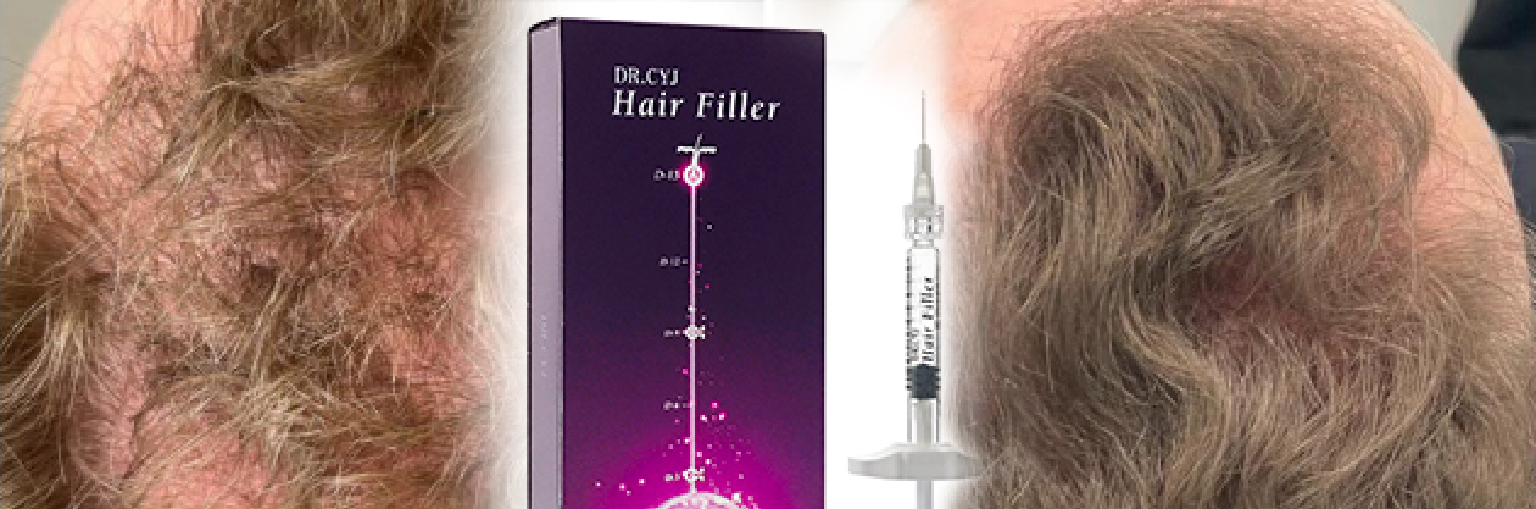 Rembourrage de cheveux par DR. CYJ : la solution contre la chute des cheveux