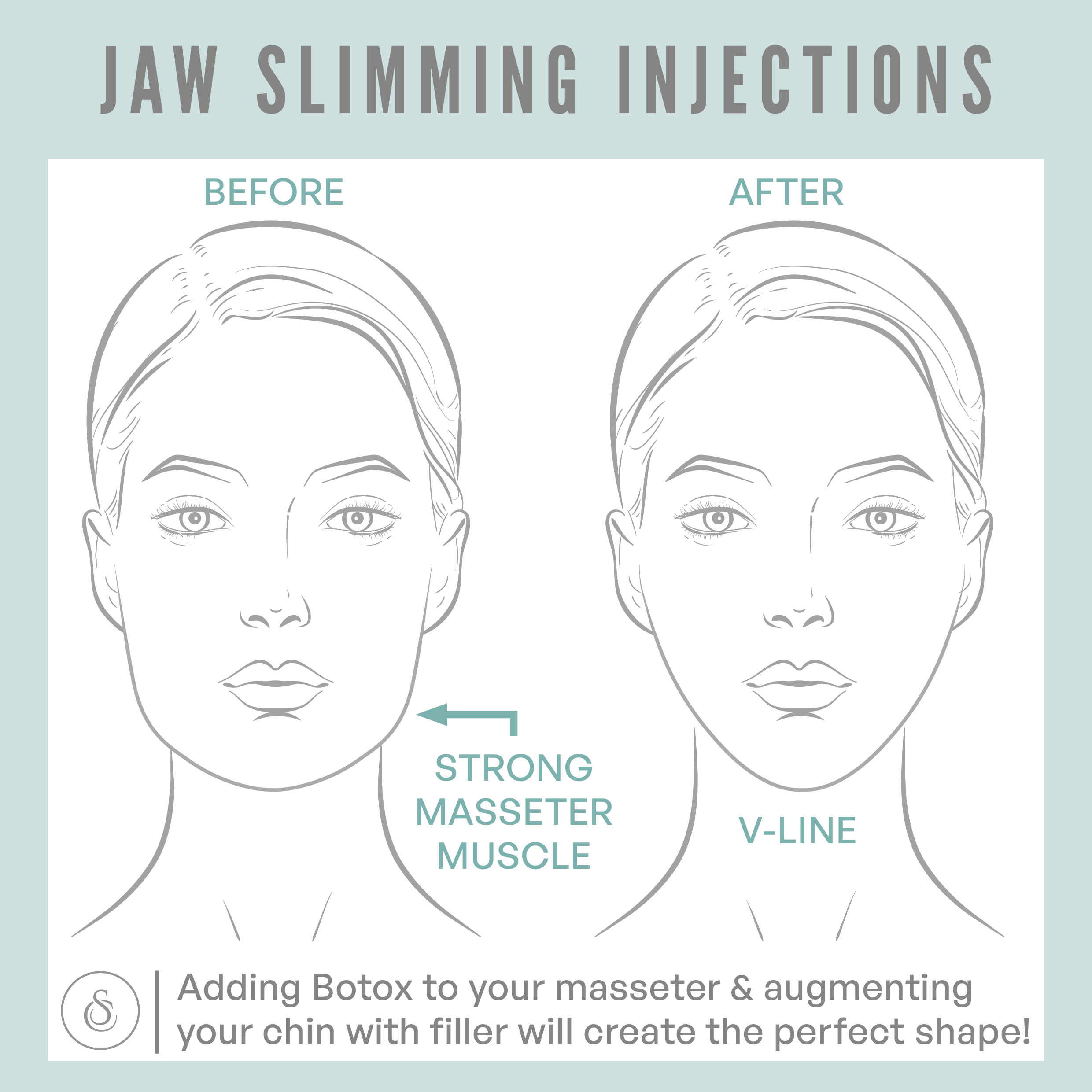 Sarasin Clinic Jaw Slimming Injections