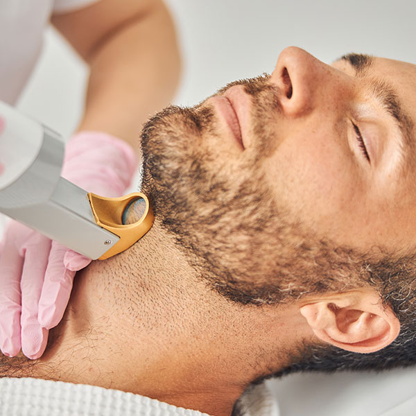 Sarasin Clinic laserontharing mannen baard