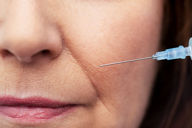 Sarasin Clinic filler neuslippenplooi anti-aging