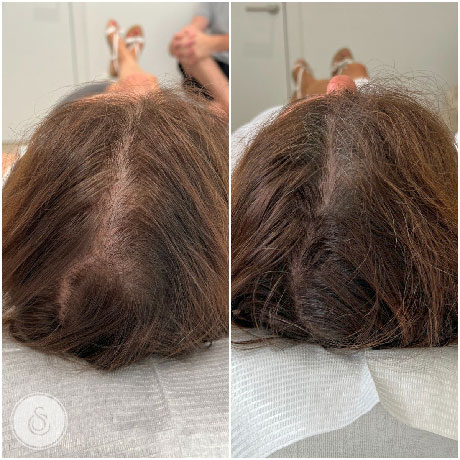 NASHI FILLER THERAPY Is so satisfying to see how just with three steps it  can change completely the condition of the hair in such a short time!😍😍  #nashi... | By Hair &