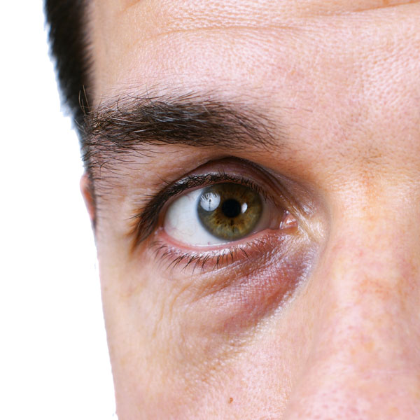Clinique Sarasin RRS yeux anti vieillissement yeux gonflés