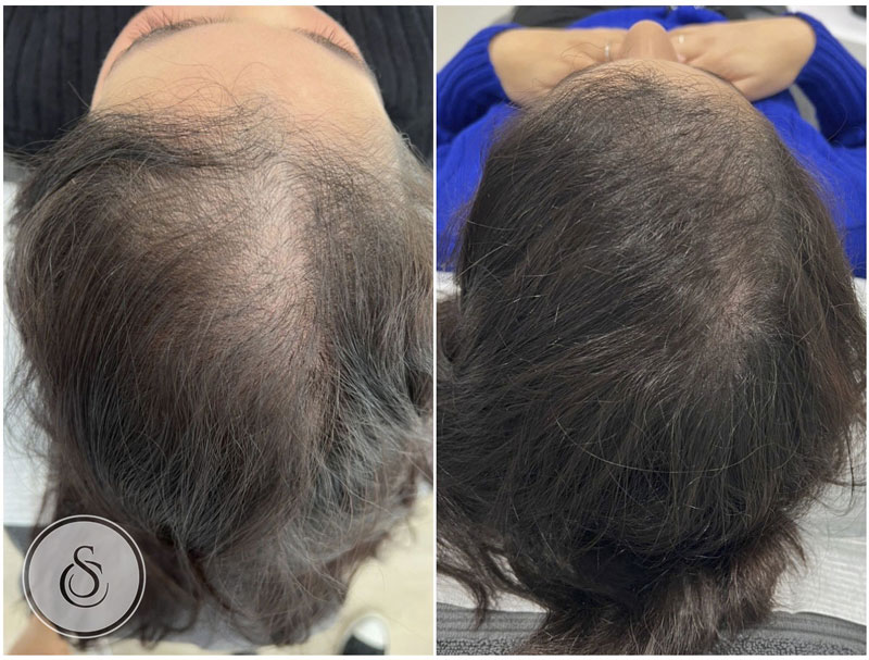 FarmStay Ceramide Damage Clinic Hair Filler – BetterSkin