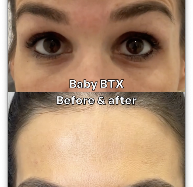 Baby BTX before and after
