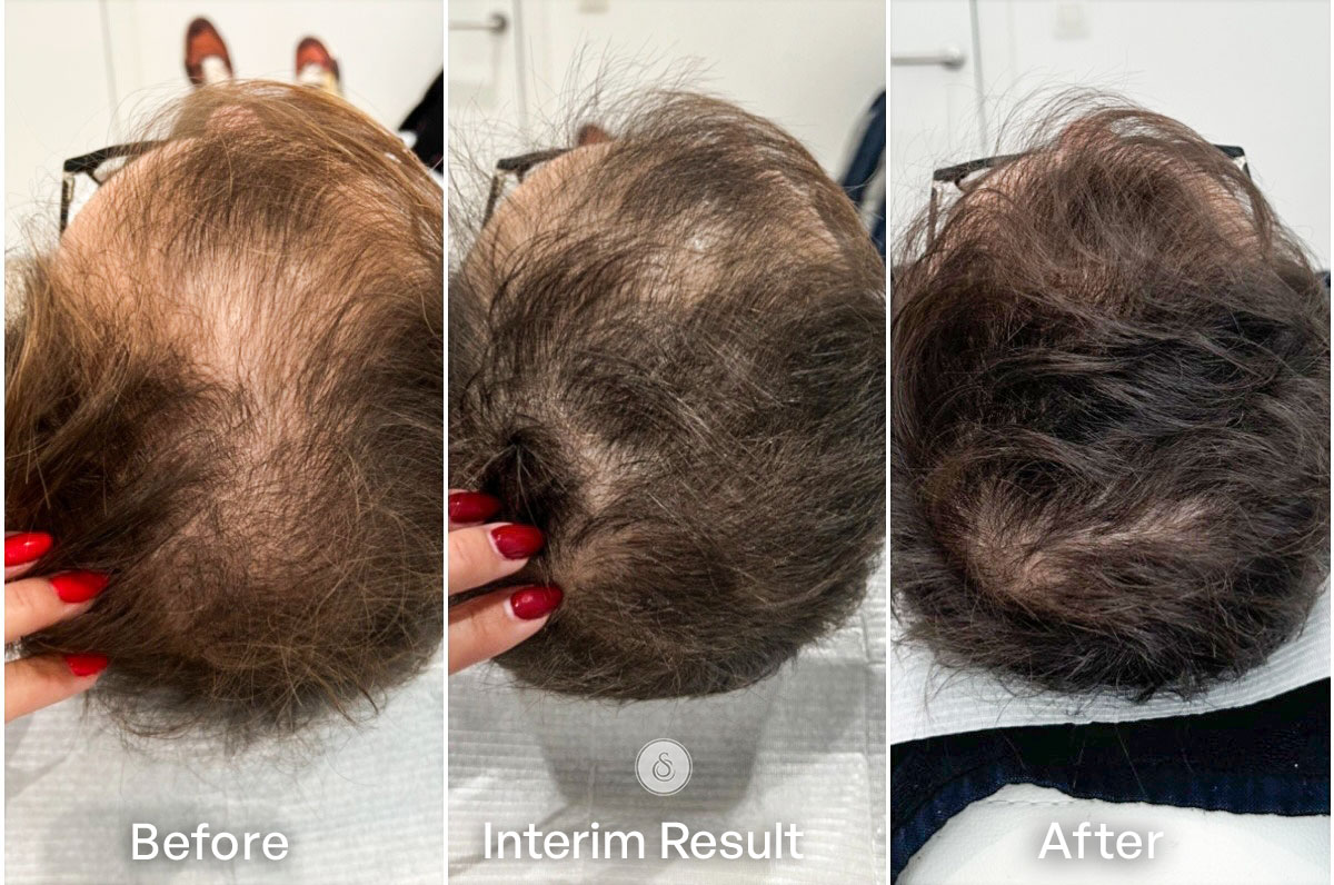 Ultimate treatment in our Studio. Hair Filler Therapy 🏆 Who cant resist  soft, silky and healthy hair like this 😍 Go get yours done only a… |  Instagram