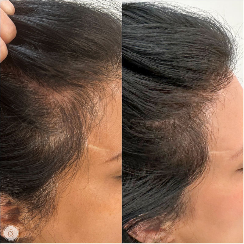 Dầu gội phục hồi tái tạo tóc Nashi Filler Therapy 250ML | Lazada.vn