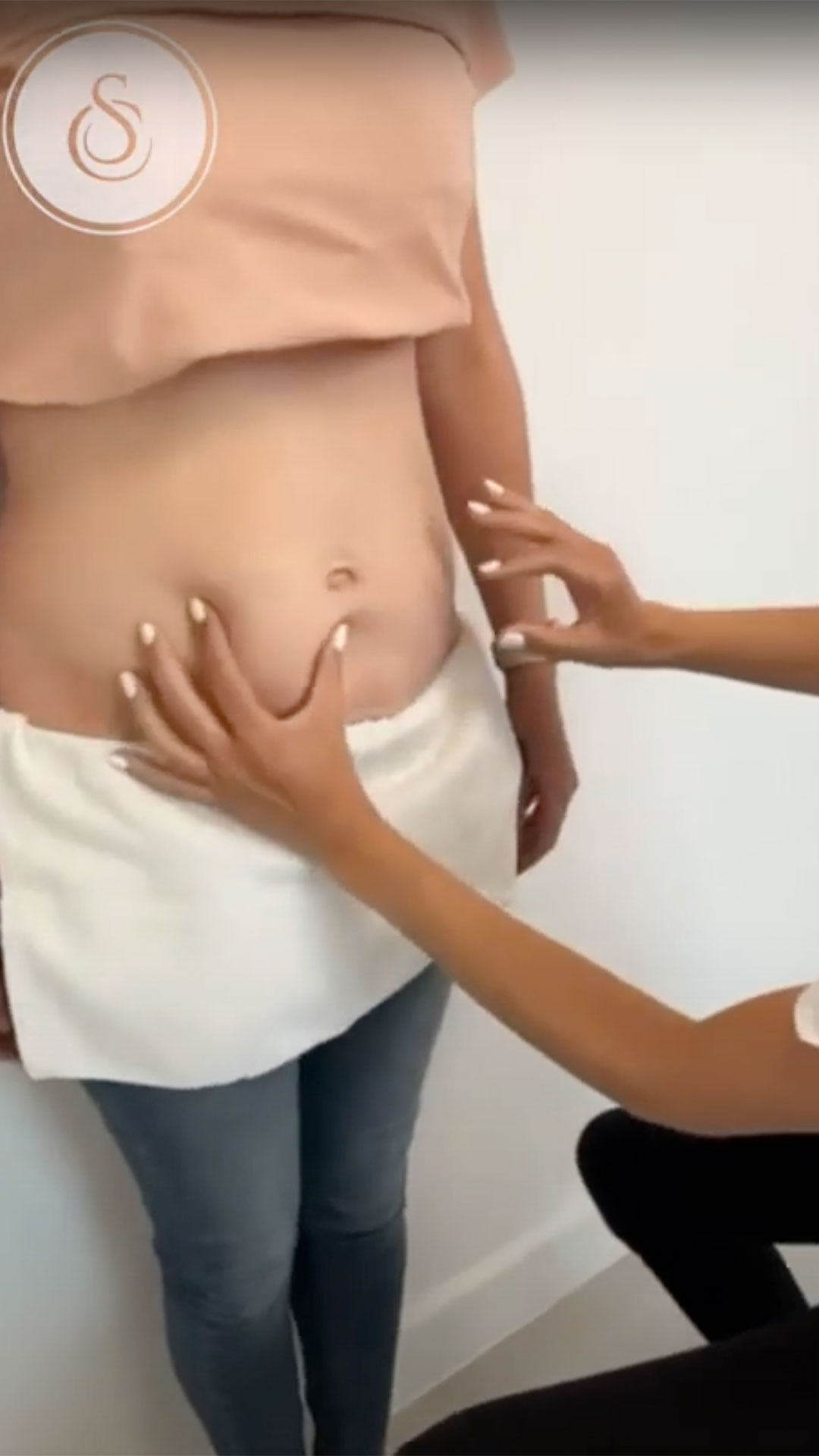 SarasinClinic_video-HIFU-Body–Uitleg-+-Demonstratie