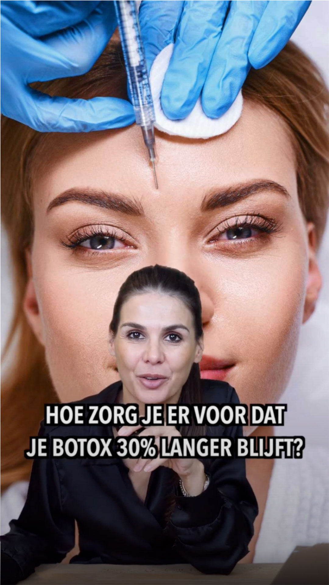SarasinClinic_video_BOTOX-HACK-Get-a-longer-effect-of-Botox