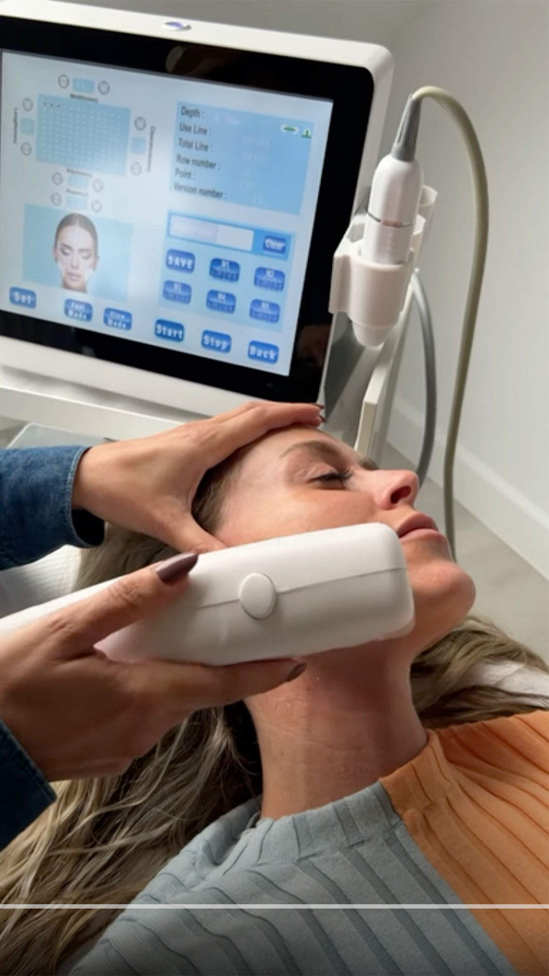 SarasinClinic_video_HIFU-Face-Demonstratie