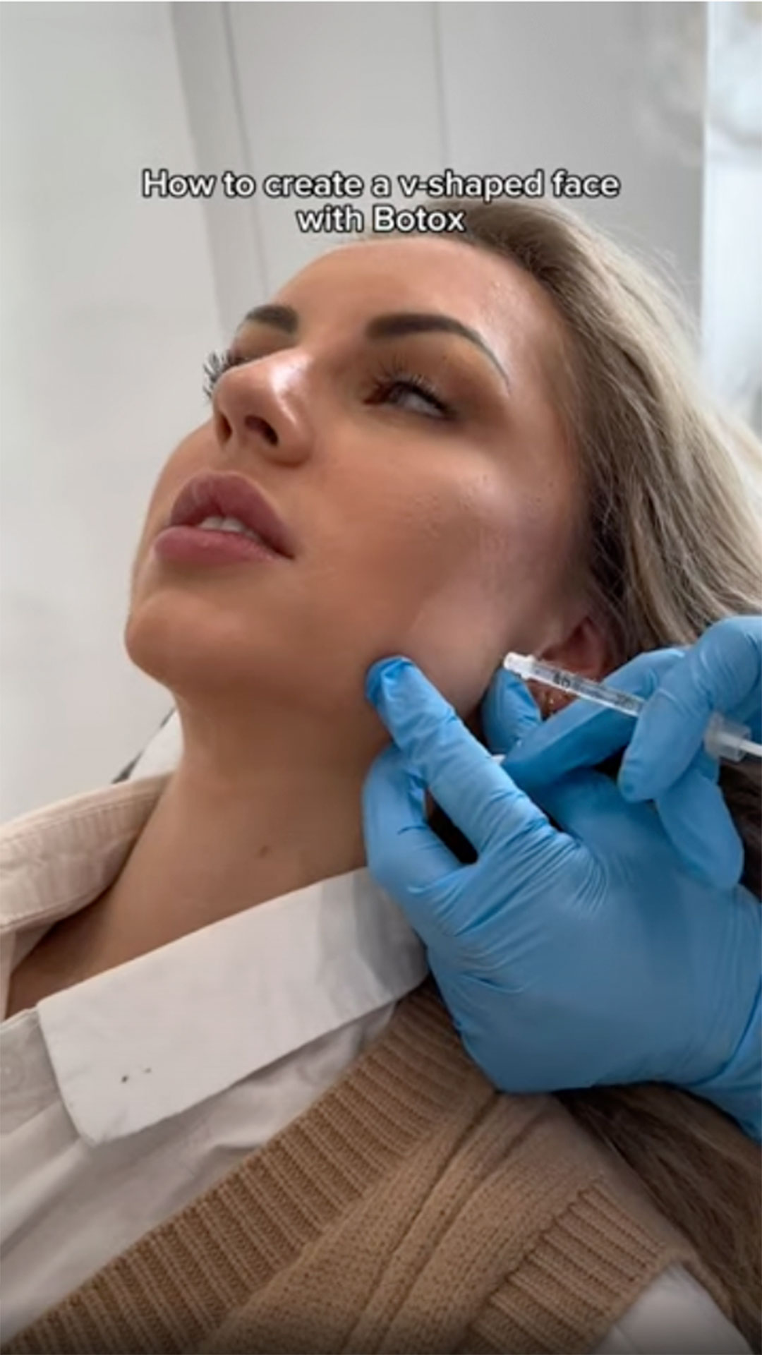 SarasinClinic_video_Masseter-botox-against-grinding-and-clenching Sarasin Clinic video Masseter botox against grinding and clenching
