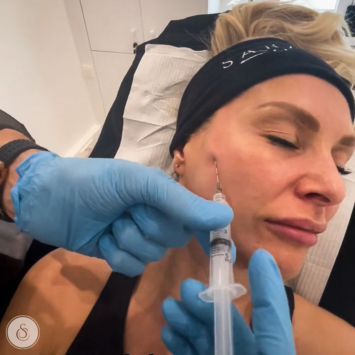 sarasin clinic injecting sculptra