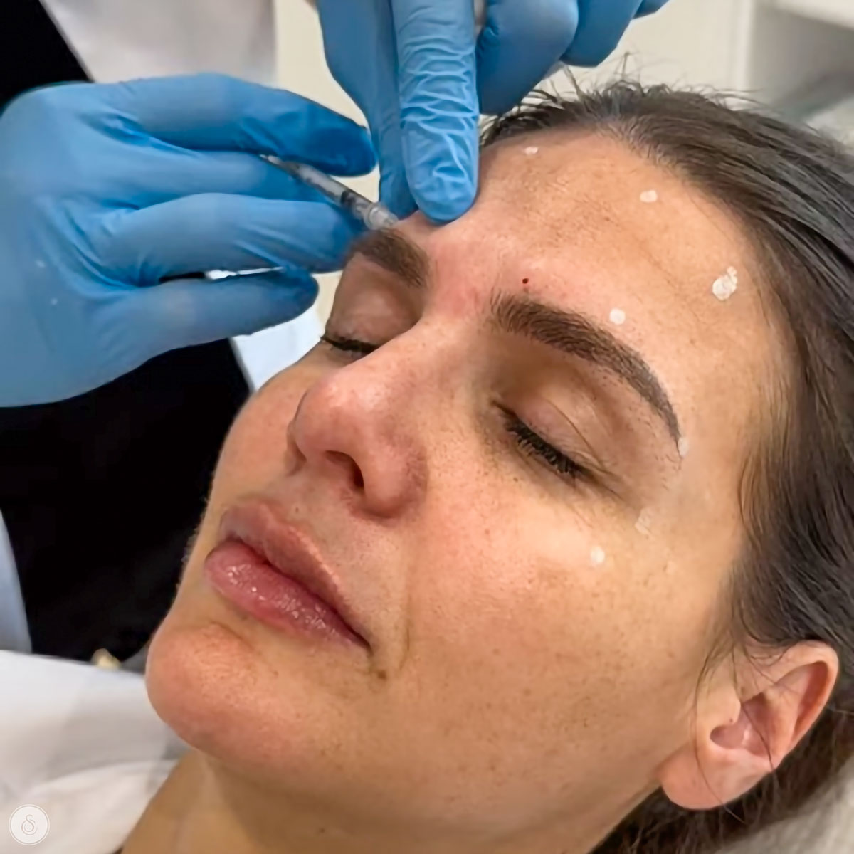 sarasin clinic botox kliniek antwerpen gent